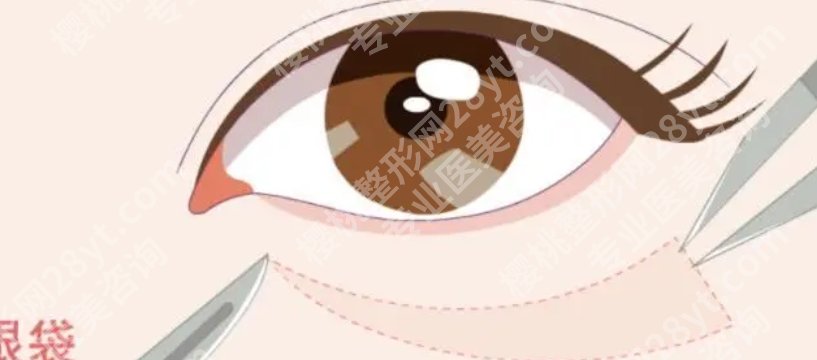 宁波第六医院祛眼袋多少钱？当地参考5093元起！口碑医生介绍