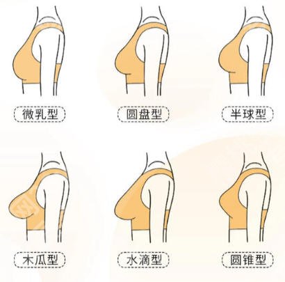 上海第十人民医院隆胸价格表更新！2026客户口碑真实附上！