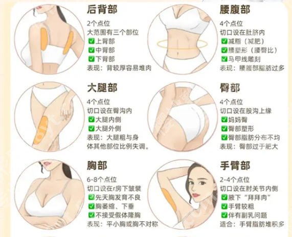 上海同济医院抽脂收费表更新！小腿抽脂2w左右起！