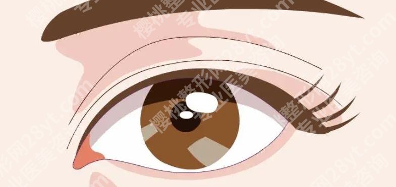 上海新华医院割双眼皮怎么样？埋线、全切、三点等那种更自然？
