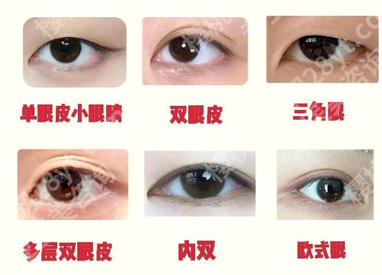 上海九院双眼皮挂哪个科？医院简介公布！附2026经典案例