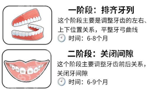 深圳北大医院牙齿矫正价格表公布！价格表、医院医生信息速码！