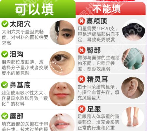 北京大学深圳医院脂肪填充全脸怎么样？看完这份真实反馈再做决定不踩坑