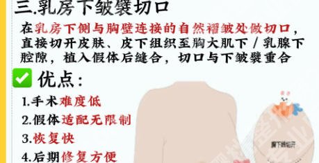 上海第十人民医院隆胸专家怎么样？医生详解与案例分析