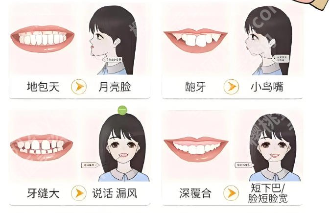 东莞常平医院有种植牙齿吗？医院基本信息公布！含人气医生名单