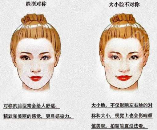 上海六院磨骨手术费用揭晓！收费明细及术后真实反馈一篇看懂