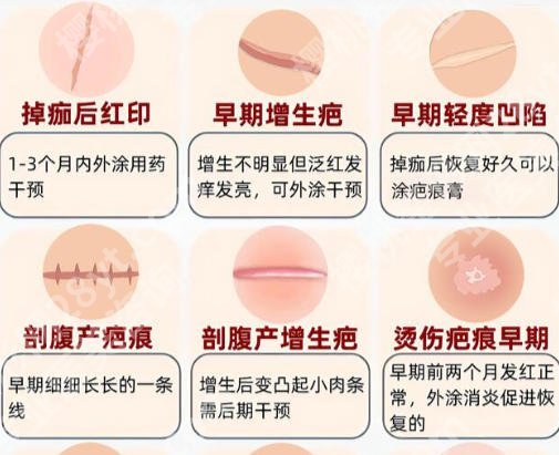 上海仁济医院去疤痕多少钱？效果、价格全透明
