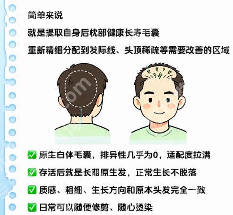 南宁市第二人民医院植发怎么样？价格、技术对比与术后效果大起底