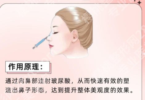 上海九医院隆鼻假体取出多少钱啊？技术实力、医生推荐及2026价格表详