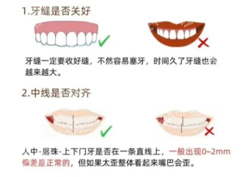 上海华东医院正畸科怎么样？牙齿矫正选公立医院正畸、体验与细节全分享