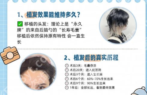 沙井人民医院植发怎么收费？不同植发面积价格参照表来啦