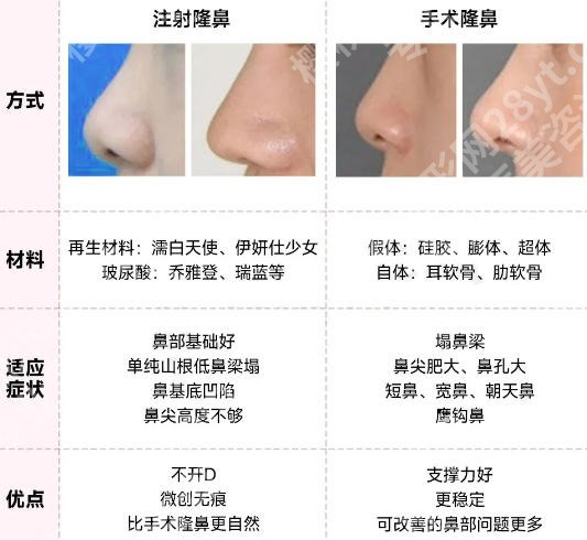 重庆医科大学附属第一医院隆鼻怎么样？隆鼻实力与网友真实评价大揭秘