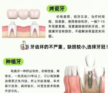 广东省中医院口腔科怎么样？种牙技术与收费一次性讲透