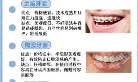 广州南方医院正畸价格公布！收费标准、医生简介这看