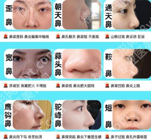 上海东方医院做鼻子多少钱？医师技术实力盘点