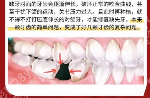 北京协和医院牙科怎么样？附 医院详细介绍与项目介绍！