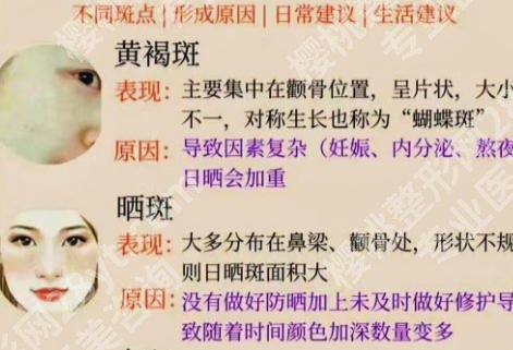 上海第八人民医院祛斑怎么样？普通人实测全流程分享