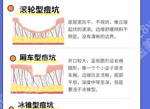 青岛大学附属医院光子嫩肤怎么样？2026新价与避坑指南、普通人必看