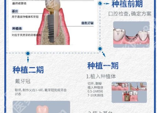 广州华侨医院口腔科看病贵吗？项目明细与性价比全面解析