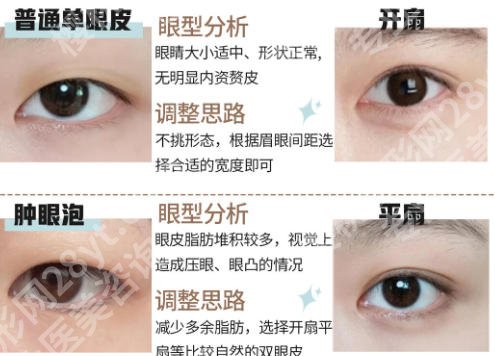 珠海人民医院割双眼皮价格揭晓！网友真实评价一览！