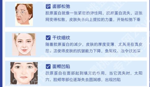 深圳北大医院拉皮手术怎么样？术后注意事项盘点公示！