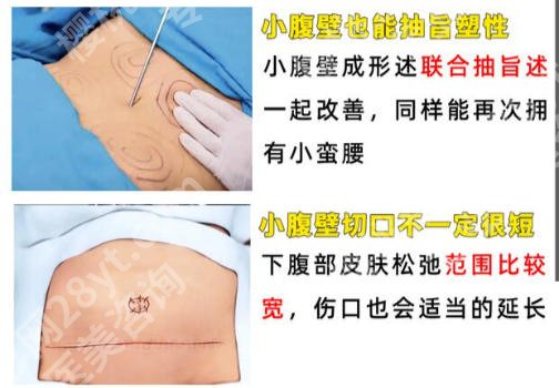上海交大附属仁济医院抽脂怎么样？真实收费拆解、避坑指南