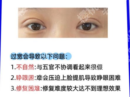重庆新桥医院做双眼皮多少钱？价格及避坑指南严选