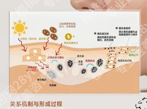 无锡第二人民医院美容科祛斑怎么样？更新医生名单推荐！