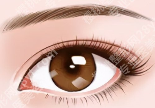 广州眼修复谭敏峰怎么样？口碑点评/擅长项目/经典案例揭晓