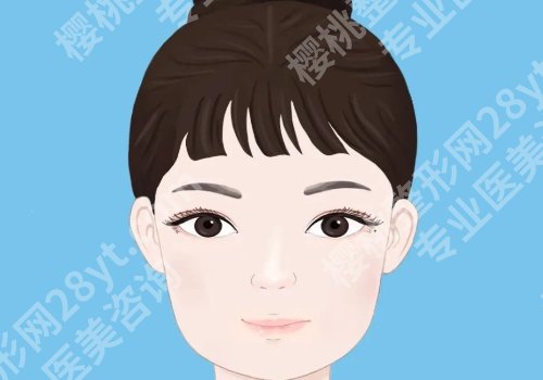洛阳双眼皮修复徐永飞医生怎么样？假宽深/肉条眼修复效果实测