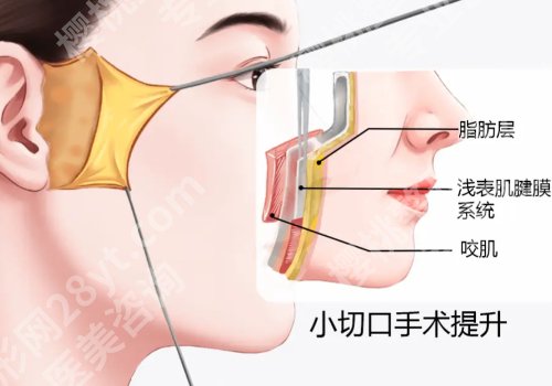 大连眼修复刘志刚也会拉皮吗？【全能型】专家，技术特色解析