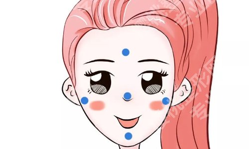 武汉眼修复方涛案例以自然风格为主、术后稳定性强