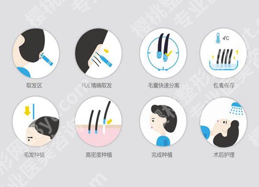 开封第二人民医院植发怎么样？真实体验与本地建议这看