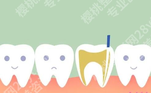 上海九院牙齿根管治疗多少钱一颗？费用表+科室情况这里扒透