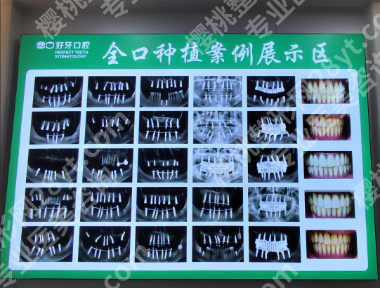 北京看牙去哪儿靠谱?好牙口腔:正规连锁,品牌直供种植体,省钱又放心