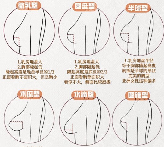 上海九院隆胸假体材料有哪些？医院简介、真实价格、真实案例展示！