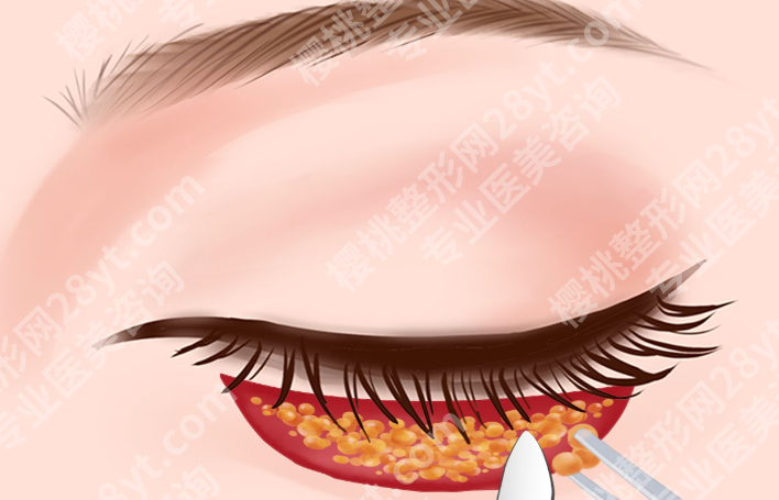 云南去眼袋哪家医院好？医美资源盘点，这几家医院关注度不低