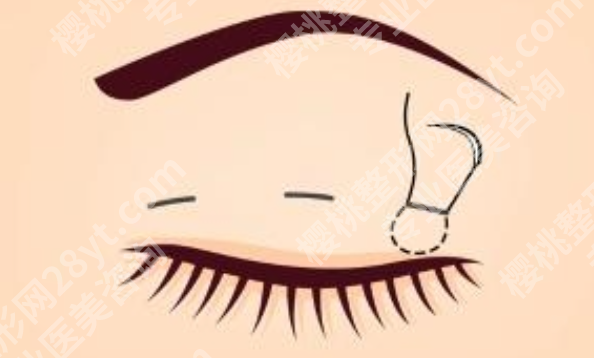 承德做双眼皮好的美容医院有哪些？2026年机构信息整理，眼整形特色一览