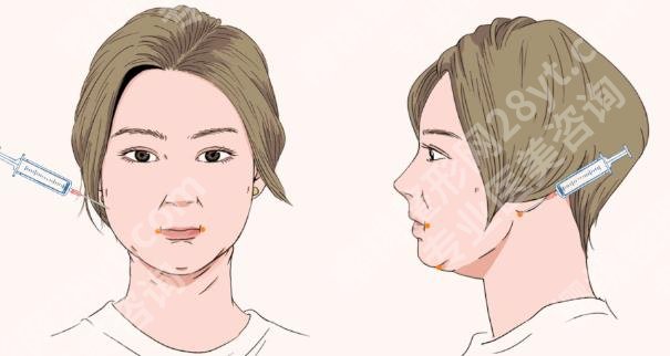 九院面部吸脂多少钱？腰部、面部等部位均价1w-3w左右！