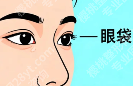 济南去眼袋哪个医生做得好？热门医生资料汇总，技术路线各有讲究