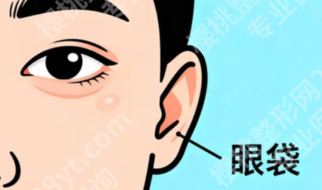 贵阳去眼袋哪家医院好？2026年10月关注名单，这些医疗机构值得了解