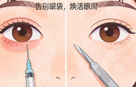 德州去眼袋医院哪家比较好?除了医院名气,影响手术选择的还有哪些因素