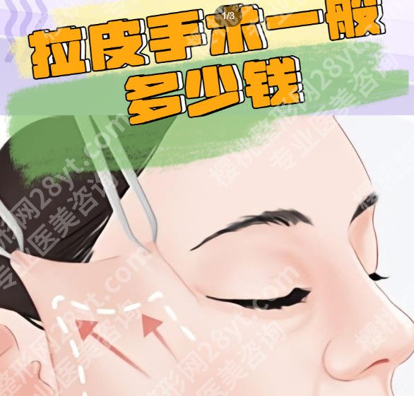 上海九院美容整形大拉皮一般多少钱?2026价目表更新!点击一览
