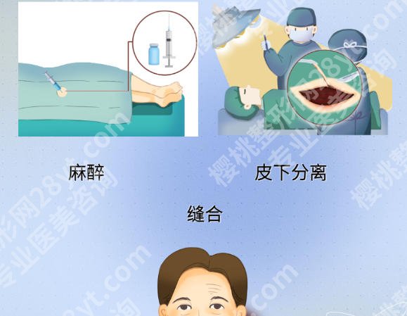 上海九院的拉皮技术好吗?医院排行榜公布!审美干货分享!