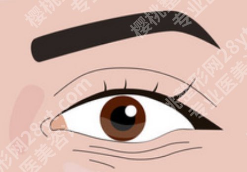杭州眼修复王璐医生怎么样？附技术特色解析+坐诊信息