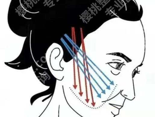 九院面部提升三件套是什么？减容、紧肤、提升等项目科普！