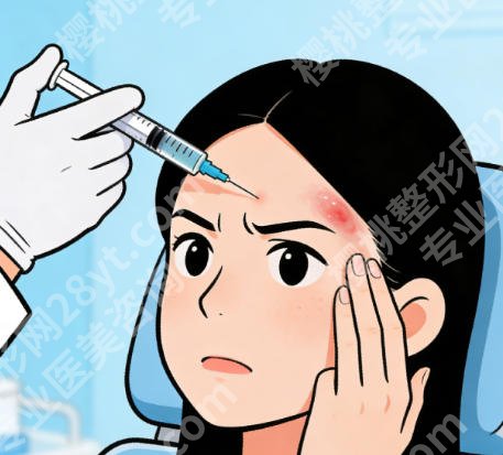 上海九院哪个医生取注射异物好？何金光、苏薇洁等技术可靠吗？